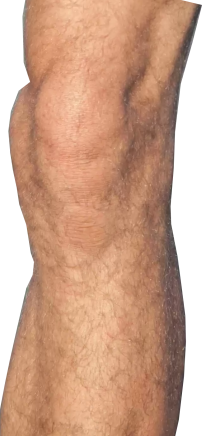 Joelho